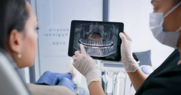 Licensed Dental Implants service in Santa Paula, CA - Smile Center Dentistry
