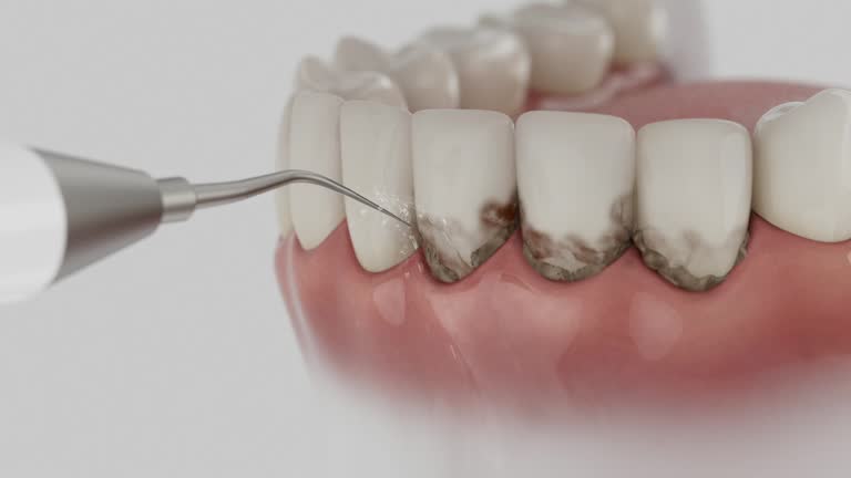 Reliable Dental Implants contractor in Santa Paula, CA by Smile Center Dentistry